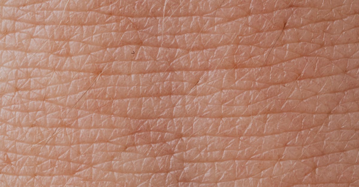 Why is dermatology research important?